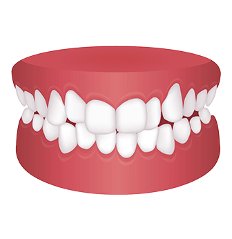 Common orthodontic problems